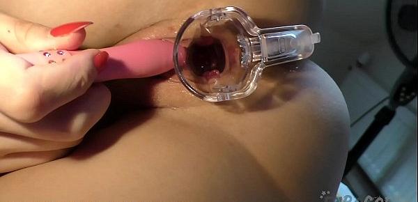  kinky gyno creative porn tiny gaping pussy stretched open during masturbation